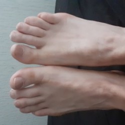 Lid