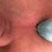 Lid