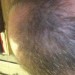 Lid